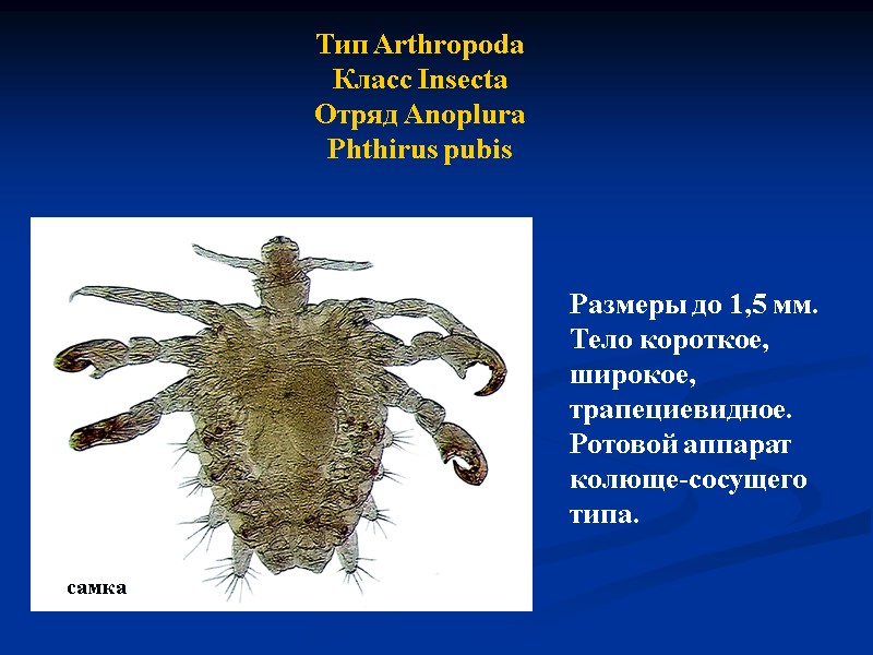 Тип Arthropoda Класс Insecta Отряд Anoplura Phthirus pubis Размеры до 1,5 мм.  Тело